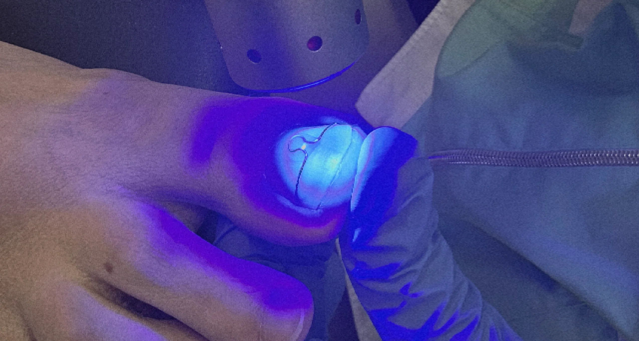 Nagelpilzbehandlung